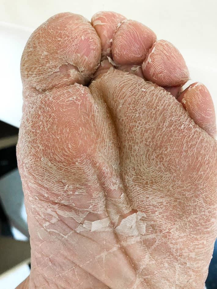 Beautyful Feet